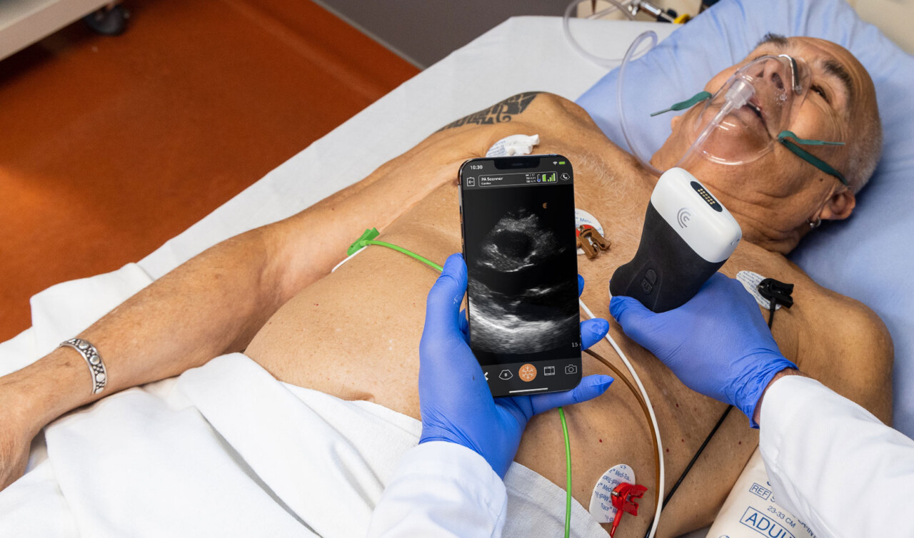 Point of Care Ultralyd